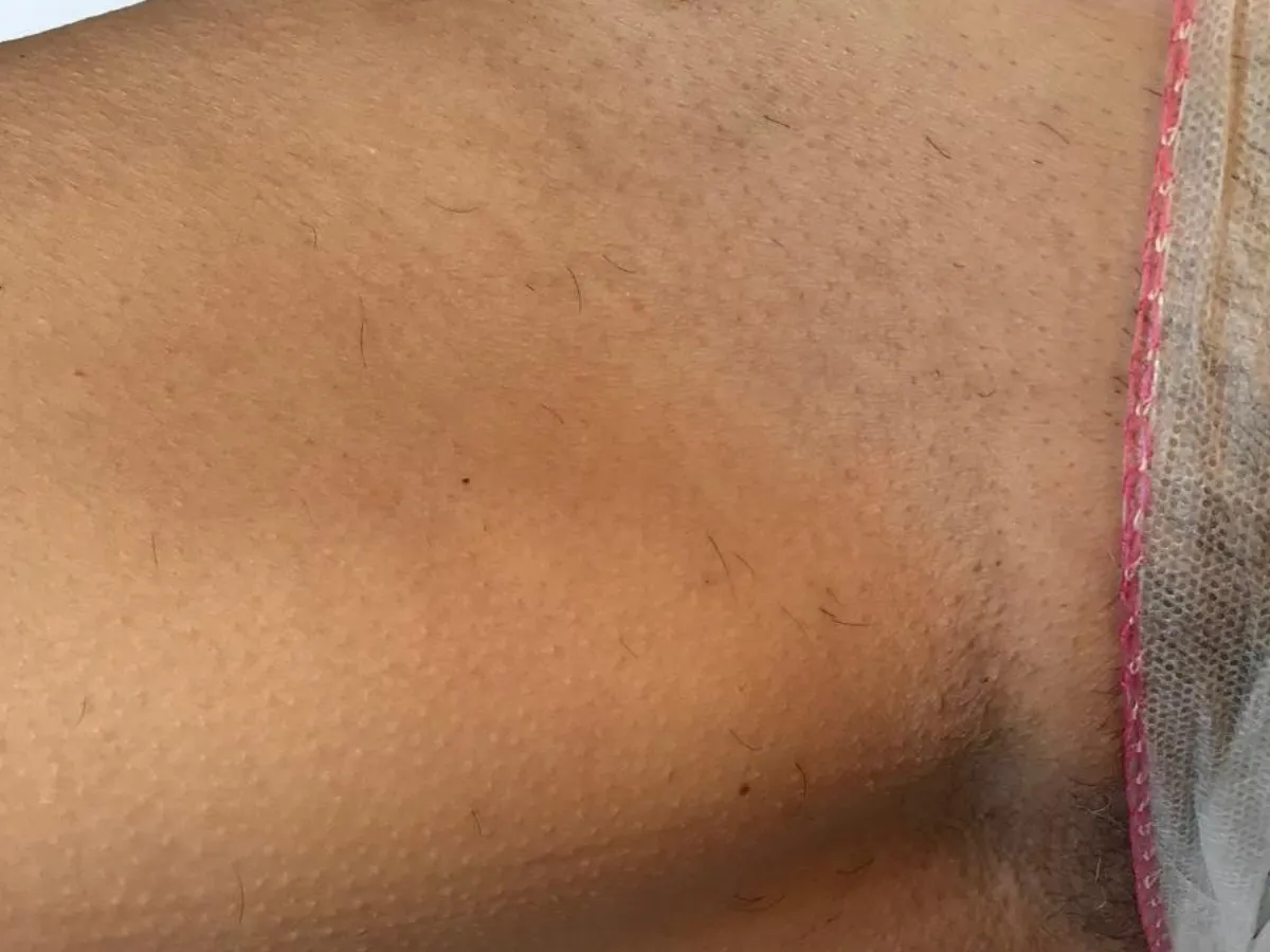 dopo